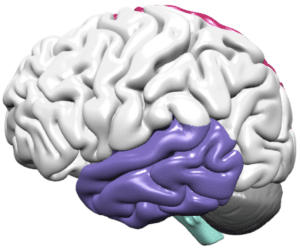 Image of temporal lobe